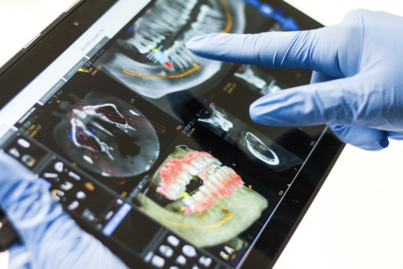 Moderne digitale Diagnostik von Zähnen und Zahnfleisch