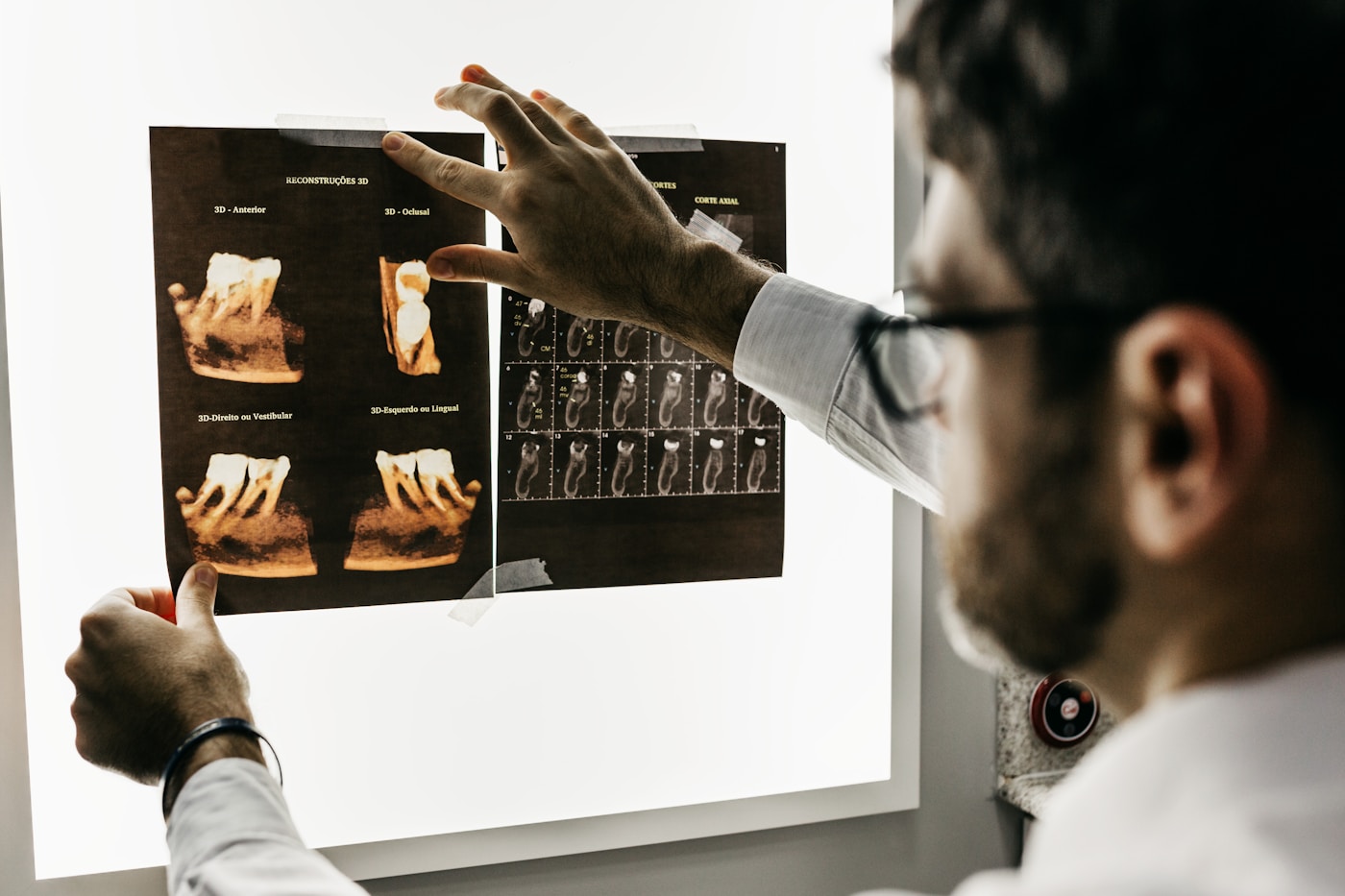 Digitale Planung einer Implantatbehandlung anhand von Kieferaufnahmen